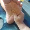 Reflexologia podal