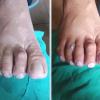 Pedicure tradicional com esfoliação e hidratação