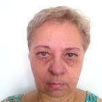 Aleta Costa Aleta Costa